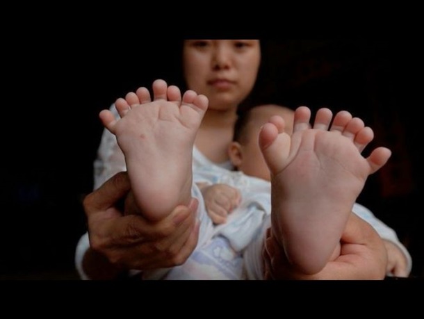 У Китаї народилася дитина з 31 пальцем Поштівка image 1